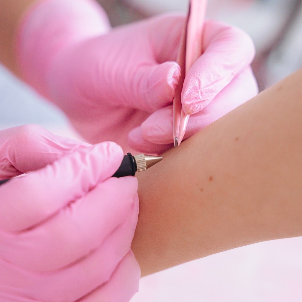 Epilation électrique à Montpellier